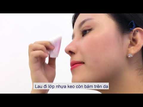 Hướng dẫn tháo nẹp mũi tại nhà Hướng dẫn tháo nẹp mũi tại nhà
