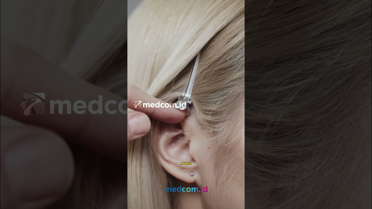 TELINGA KIRI SUKA BERDENGING? INI CARA MENGATASINYA