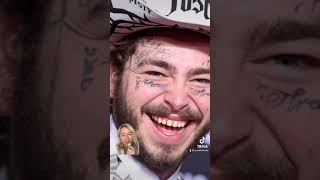 Post Malone’s teeth! #shorts #braces