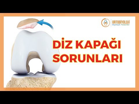 Video: Çıkık Diz ile Nasıl Başa Çıkılır (Resimlerle)