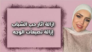 علاج التصبغات الجلدية العميقة | عناية منزليه غير مكلفة?