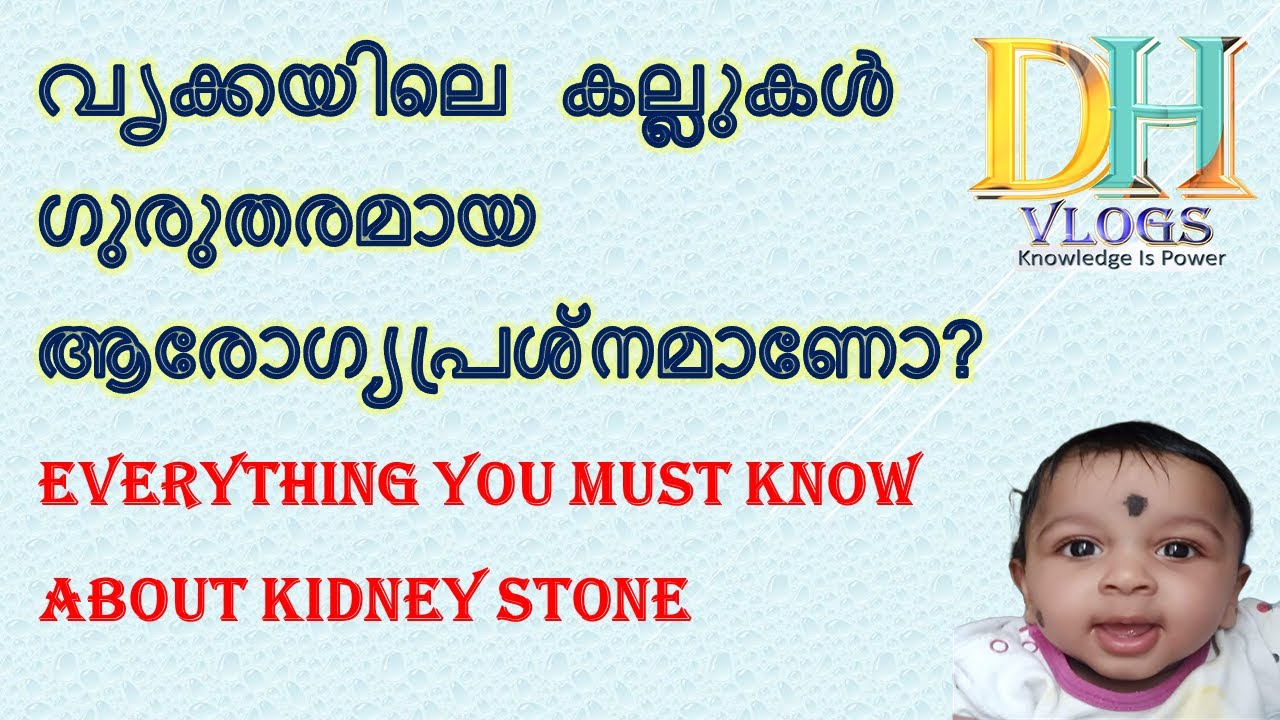 kidney stone/renal calculi/renal stones/ വൃക്ക കല്ല് explained in