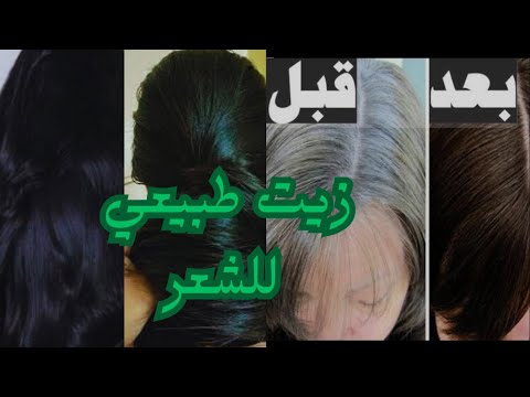 طريقه عمل زيت طبيعي علاج تساقط الشعر الثعلبة الصلع الوراثي شيب الشعر المبكر