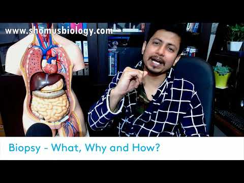 Biopsy test procedure in Hindi | Biopsy test for cancer detection