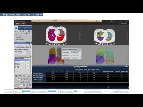 Philips IntelliSpace Portal 7.0 clinical application CT COPD (chronic obstructive pulmonary disease)