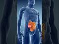 Neuropathy pain relief remedy #arteryhealth