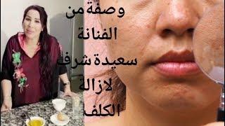 Saida charaالفنانة سعيدة شرف تقدم وصفة لإزالة الكلف و التصبغات الوجه