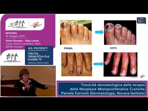 La tossicità dermatologica della terapia