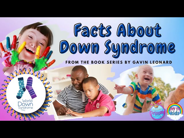 Facts about Down Syndrome