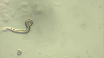 c. elegans unc-17 mutant