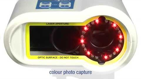 moorFLPI 2 Speckle Contrast Imager