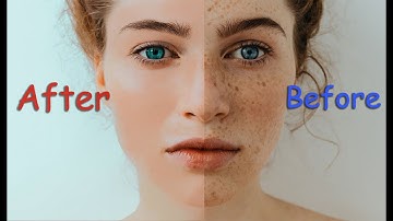 How to Quickly Smooth Skin and Remove Blemishes & Scars Photoshop Tutorial