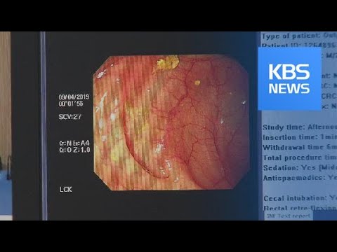 ‘2030 젊은층 위협’…<strong>염증성장질환</strong> 급증! / KBS뉴스(News)