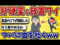 【危険】酒飲みワイ、食道のコブが破裂してしまう・・【2ch風解説】