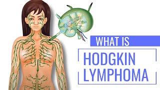 What is Hodgkin's Lymphoma: First Symptoms Explained | The Patient Story