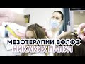 Чек-лист косметологу для мезотерапии волос