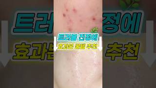 🔥트러블 진정에 찐!!으로 효과본 꿀템 추천🔥#제품제공