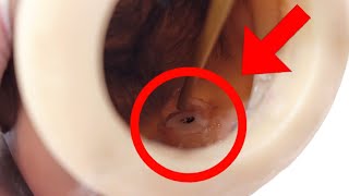 How to Put Eyes 👀 in Reborn Doll - How Does it LOOK in There?| Eye Surgery