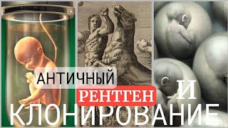 ДУБЛЬ 2🏛Сказания о Титанах: супергерои-великаны Афариды и рентгенолог Линкей