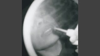 Woman Of Faces (Demo)