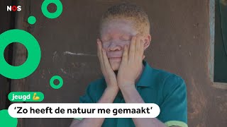 Download Lagu Zorgen in Malawi; mensen met albinisme worden bedreigd MP3