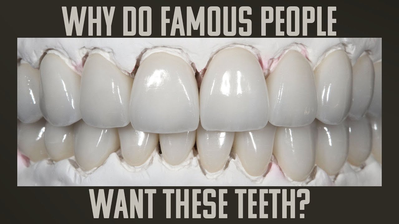 Why Do Famous People Want These Teeth?