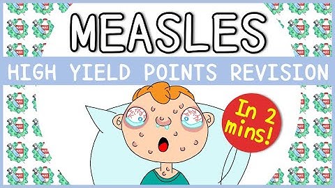 Measles: Signs & Symptoms, Microbiology, Diagnosis, Treatment and Prevention
