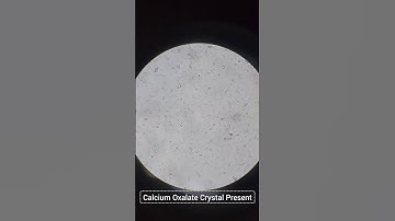 #microscope #urineanalysis #pathology #🔬 #laboratory #youtubeshorts #yashgupta9616 #🥼