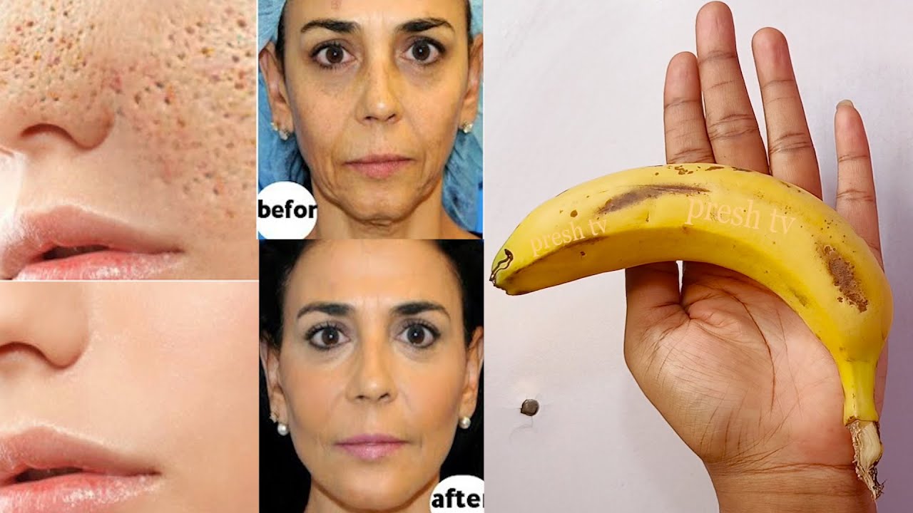 I prepared Banana Face Mask that will take you 10 years back ! pores