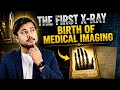 How Wilhelm Roentgen Accidentally Discovered X-Rays and Changed Medicine @insideviewing #medical