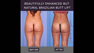 BBL — Before & After 🍑