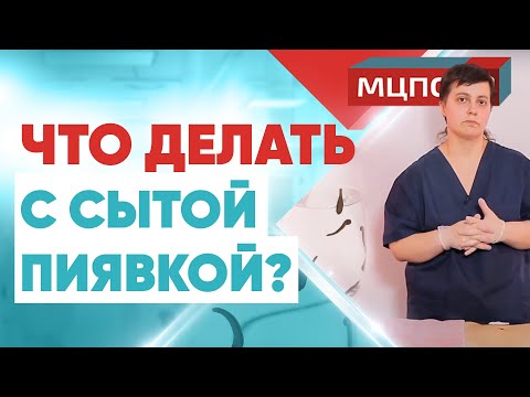 Что делать с сытой пиявкой? Курсы гирудотерапии. Обучение как ставить пиявки. Гирудотерапия