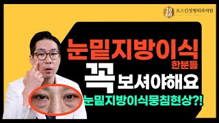 눈밑지방이식 하셨다면 꼭 보세요(뭉침현상)