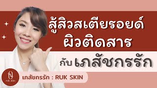 สู้สิว ผิวติดสาร สิวสเตียรอยด์ I เภสัชกรรัก RUK SKIN