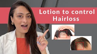 Hair loss रोकने का लोशन | Minoxidil | कैसे लगाए, कब असर दिखेगी | पूरी जानकारी | त्वचा के डॉक्टर