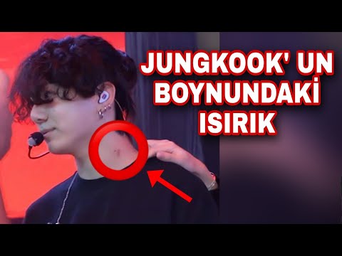 JUNGKOOK'UN boynundaki gizemli ısırık! Ve nedeni?