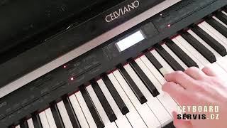 Electronic Keyboard Instruments | Key Velocity Issues | Keys Silent or Too Loud screenshot 3