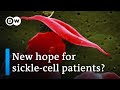 Could gene therapy be a gamechanger in the fight against sickle-cell anemia? | DW News