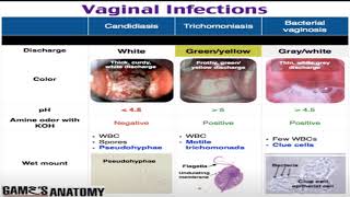 lecture  Genital infection &  STDs screenshot 2