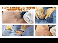 頚部の粉瘤　ブログでも粉瘤について詳しく解説してます。東京皮膚のできものと粉瘤クリニック　ふるばやし形成外科新宿院　大阪梅田形成外科クリニック