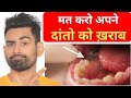 दांतो की Problems का सिर्फ एक उपाए (Bleeding Gums, Tooth Pain, Ulcers) | Fit Tuber Hindi