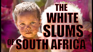 SOUTH AFRICAN WHITE SLUMS  The poverty in the White Squatter Camps