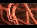 Medical animation  3d animation  vidpaq