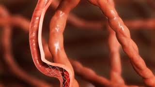 Medical Animation Video | 3D Animation video | Vidpaq