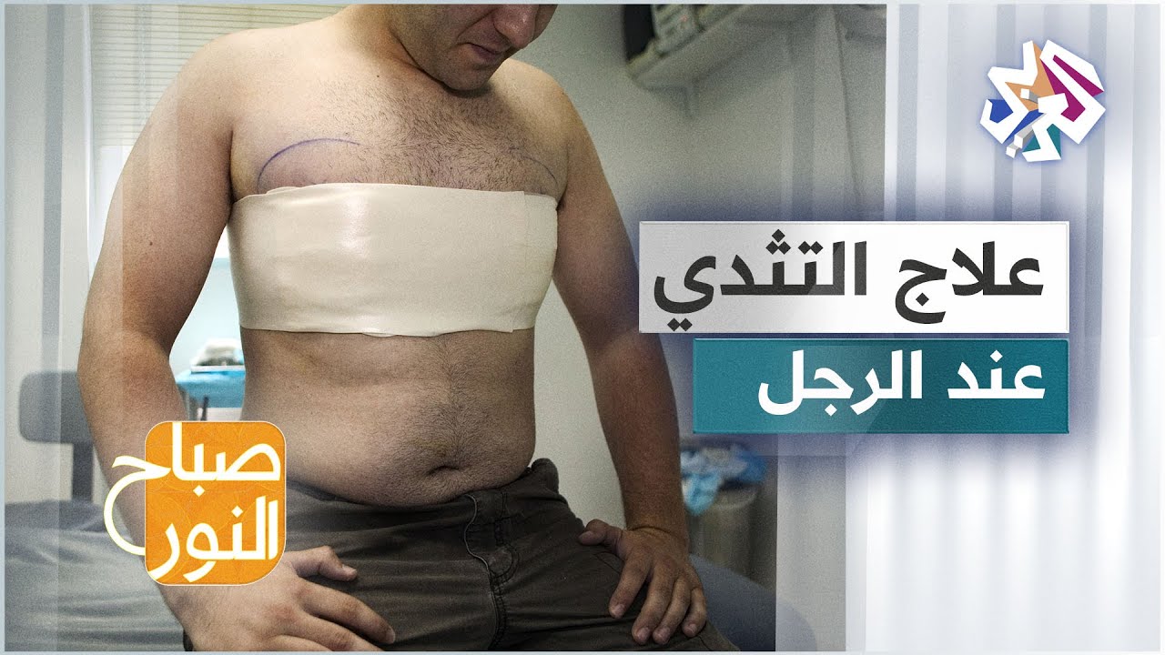 التثدي عند الرجال .. الأسباب والأعراض وطرق العلاج