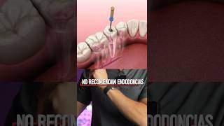 NO recomiendan las endodoncias dentistas biológicos