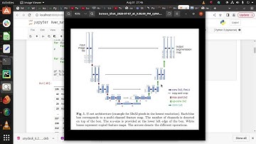 Classification & Segmentation of Liver Tumor|  3D-UNET | PyTorch  |+91-7973788405 for query