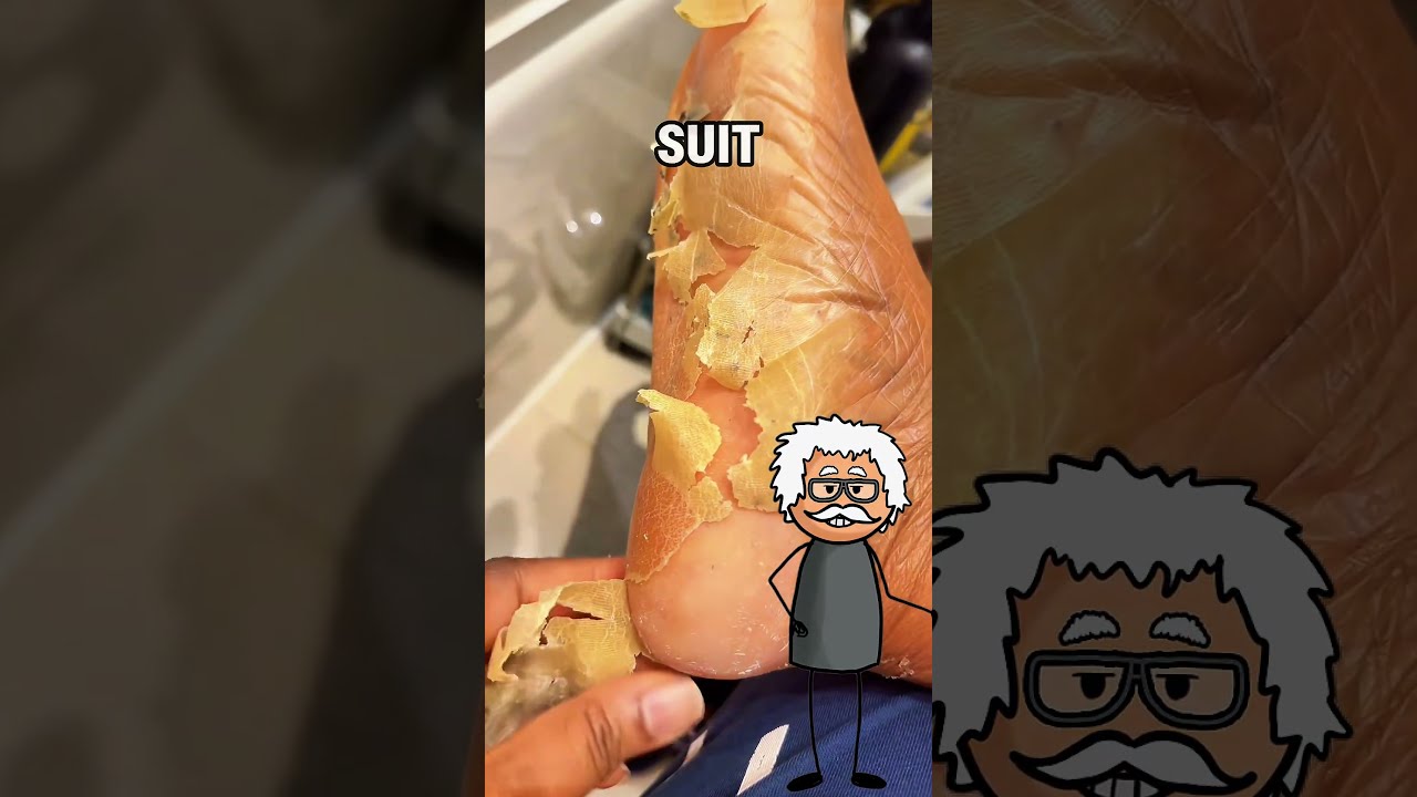 The Shocking Reason Your Skin Peels Overnight 