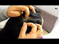 🌜Full concentration scalp checking 😴 tickremoval | carikutu | dandruffscratching | haircombing