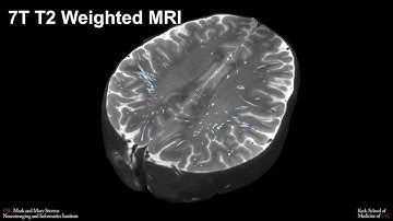 Ultrahigh Field MRI - The Value of Fine-Grained Examination